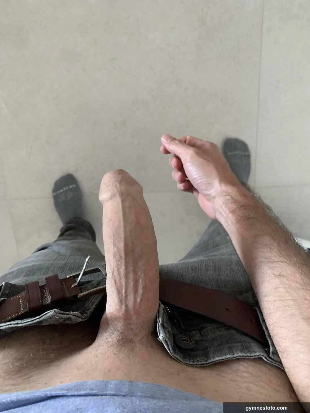 Massive foreskin
